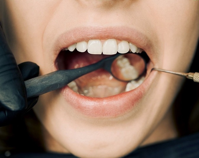 Oral Cancer Treatment